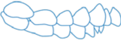 Teeth Image 1