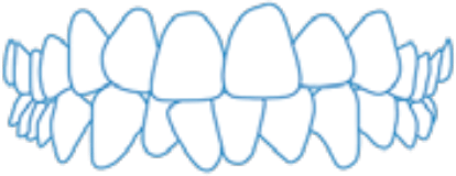 Teeth Image 3