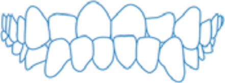 Teeth Image 4