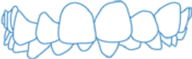Teeth Image 6